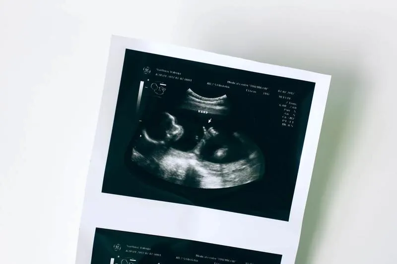 Badania USG podczas ciąży – jak często i w którym tygodniu?