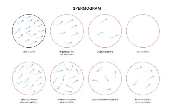 Azoospermia i leczenie