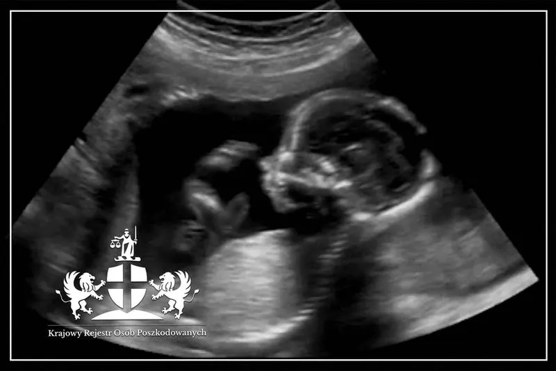 Badania prenatalne w ciąży