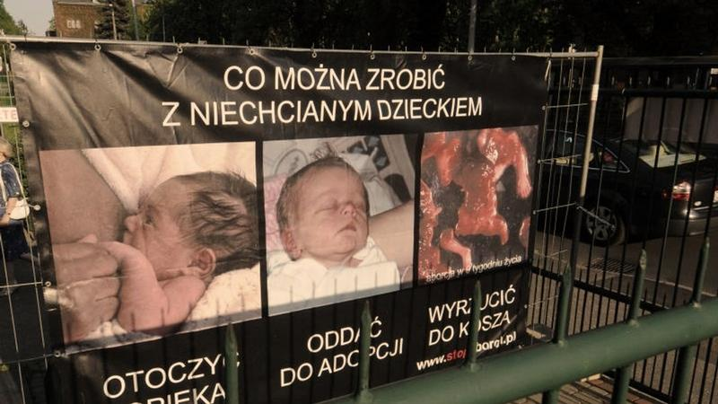 Metody aborcji