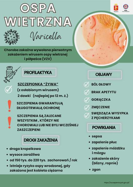 Okres zakaźności ospy