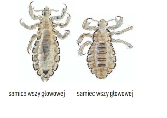 Zapobieganie wszawicy