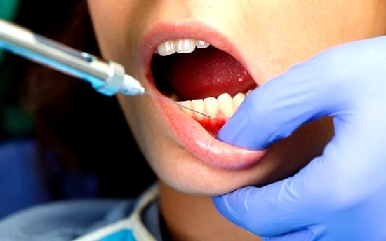 Znieczulenie dentystyczne w ciąży